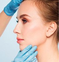 Rinoplastica Bergamo