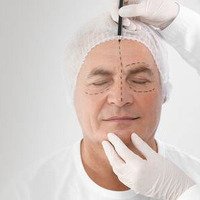 Rinoplastica in Italia